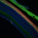 Histopathology Mouse Retina - Normal Histopathology Mouse Retina - Normal